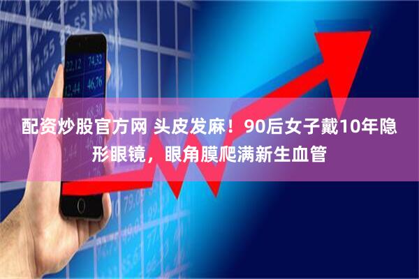 配资炒股官方网 头皮发麻！90后女子戴10年隐形眼镜，眼角膜爬满新生血管